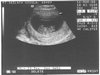 B10weeks.jpg