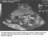 B18weeks.jpg