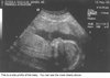 B18weeks2.jpg